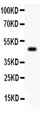 Anti-Csk Antibody Picoband®