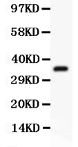 Anti-FSH beta/FSHB Antibody Picoband®