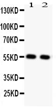 Anti-Glucose Transporter GLUT4/SLC2A4 Antibody Picoband®