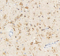 Anti-Kv2.1/KCNB1 Antibody Picoband®