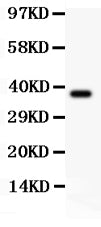 Anti-CIAS1/NALP3/NLRP3 Antibody Picoband®