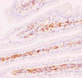 Anti-P Glycoprotein Picoband antibody, RP1034-1.JPG
IHC(F): Mouse Intestine Tissue