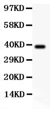 Anti-RIP/RIPK1 Antibody Picoband®