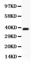 Anti-Hamartin/TSC1 Antibody Picoband®