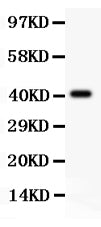 Anti-Tuberin/TSC2 Antibody Picoband®