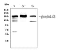 Anti-Angiotensin Converting Enzyme 1/ACE Antibody Picoband®