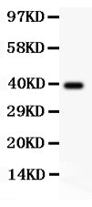 Anti-Angiopoietin 1/ANGPT1 Antibody Picoband®