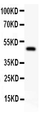 Anti-alpha 1 Catenin/CTNNA1 Antibody Picoband®