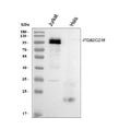Anti-CD18/ITGB2 Antibody Picoband®
