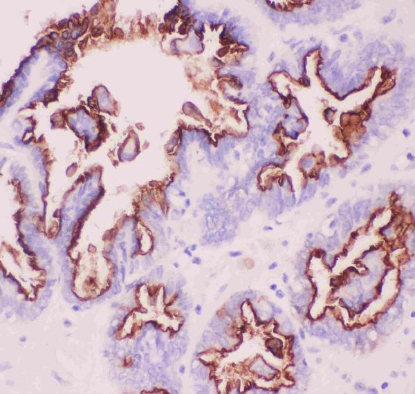Anti-MUC1 Antibody