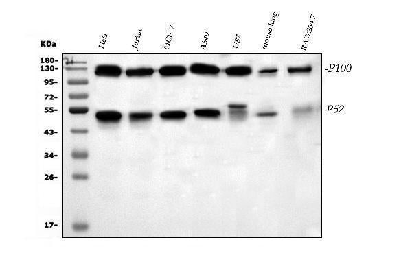 Anti-NFkB/NFKB2 p100/p52 Antibody Picoband®