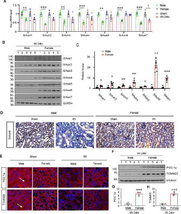 Anti-SIRT1 Antibody Picoband®