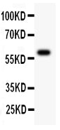 All lanes: Anti ATM (RP1040) at 0.5ug/ml
WB: Recombinant Human ATM Protein 0.5ng
Predicted bind size: 60KD
Observed bind size: 60KD