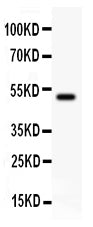 Anti-KAT3B/p300/EP300 Antibody Picoband®