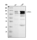 Anti-EPB41L1 Antibody Picoband®
