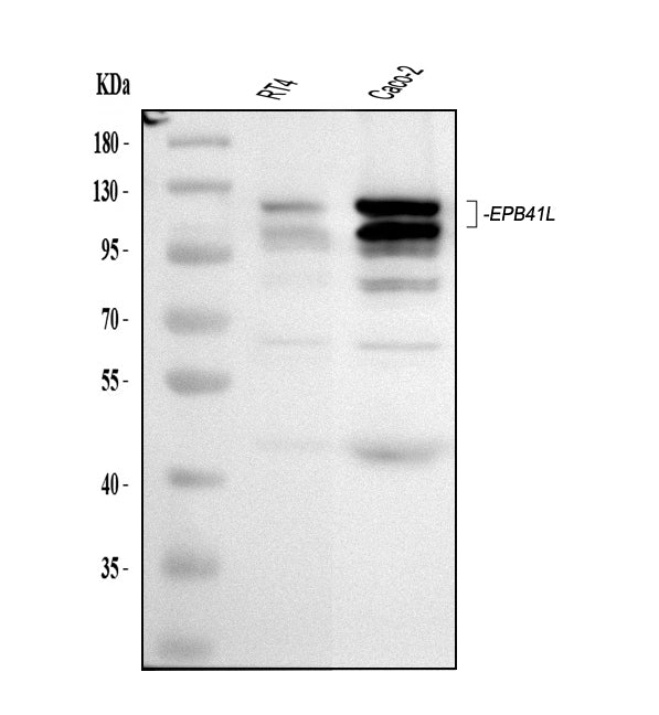 Anti-EPB41L1 Antibody Picoband®