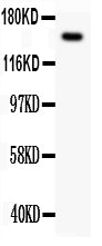 Anti-Met (c-Met) Antibody Picoband®