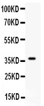Anti-C5/C5a Antibody Picoband®