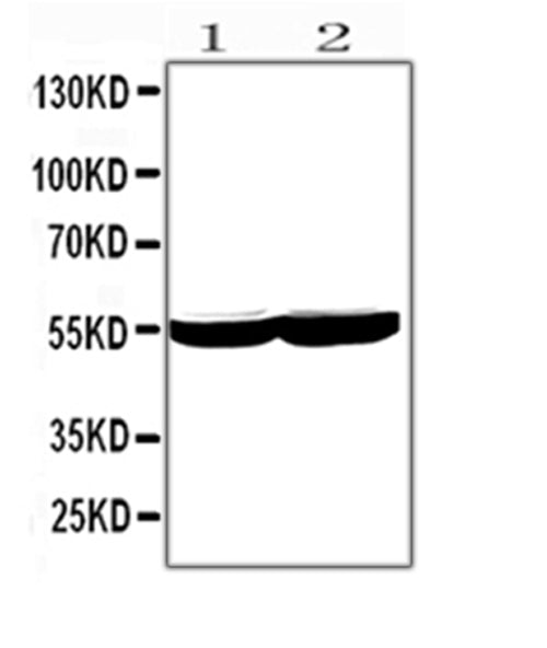Anti-Cytochrome P450 2E1/CYP2E1 Antibody Picoband®