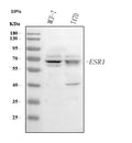Anti-Estrogen Receptor/ESR1 Antibody Picoband®