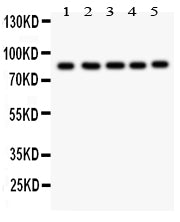Anti-FOXM1 Antibody Picoband®
