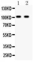 Anti-Glutamate receptor 3/GRIA3 Antibody Picoband®