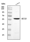 Anti-HEXB Antibody Picoband®