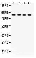 Anti-IKK beta/IKBKB Antibody Picoband®
