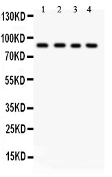 Anti-IKK beta/IKBKB Antibody Picoband®