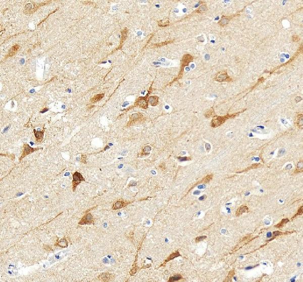 Anti-IP3 receptor/ITPR1 Antibody Picoband®