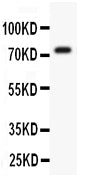 Anti-Kv4.3 antibody, PB9229, Western blotting
All lanes: Anti Kv4.3 (PB9229) at 0.5ug/ml
WB: Mouse Brain Tissue Lysate at 50ug
Predicted bind size: 73KD
Observed bind size: 73KD