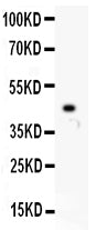 Anti-p73 antibody, PB9235, Western blotting
All lanes: Anti p73 (PB9235) at 0.5ug/ml
WB: Recombinant Human p73 Protein 0.5ng
Predicted bind size: 45KD

Observed bind size: 45KD