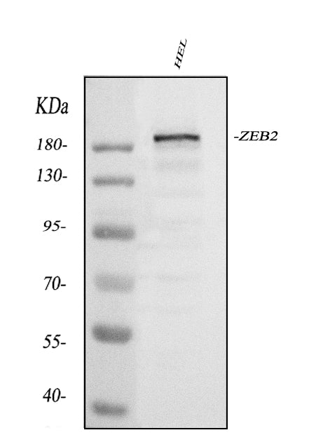 Anti-Smad Interacting Protein 1/ZEB2 Antibody Picoband®