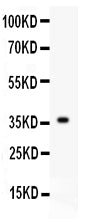 Anti-FGF1 antibody, PB9241, Western blotting
All lanes: Anti FGF1 (PB9241) at 0.5ug/ml
WB: Recombinant Human FGF1 Protein 0.5ng
Predicted bind size: 36KD
Observed bind size: 36KD