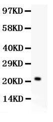 Anti-IL-18 Picoband antibody, PB9245, Western blotting
All lanes: Anti IL-18 (PB9245) at 0.5ug/ml
WB: Recombinant Mouse IL-18 Protein 0.5ng
Predicted bind size: 22KD
Observed bind size: 22KD