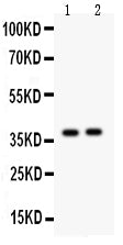 Anti-Calretinin Picoband antibody, PB9248, Western blotting
All lanes: Anti Calretinin (PB9248) at 0.5ug/ml
Lane 1: Rat Brain Tissue Lysate at 50ug
Lane 2: Mouse Brain Tissue Lysate at 50ug
Predicted bind size: 31KD
Observed bind size: 38KD