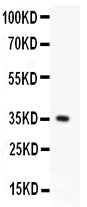 Anti-FAS Picoband antibody, PB9252, Western blotting
All lanes: Anti FAS (PB9252) at 0.5ug/ml
WB: Recombinant Human FAS Protein 0.5ng
Predicted bind size: 35KD
Observed bind size: 35KD