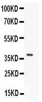 Anti-KCND1 Picoband antibody, PB9256, Western blotting
All lanes: Anti KCND1 (PB9256) at 0.5ug/ml
WB: Recombinant Human KCND1 Protein 0.5ng
Predicted bind size: 39KD
Observed bind size: 39KD