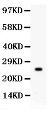 Anti-Picoband antibody, PB, Western blotting
All lanes: Anti Kallikrein 4 (PB9260) at 0.5ug/ml
WB: Recombinant Human Kallikrein 4 Protein 0.5ng
Predicted bind size: 25KD
Observed bind size: 25KD