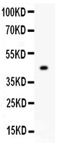 Anti-Mitofusin 2/MFN2 Antibody Picoband®