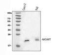 Anti-MGMT Antibody Picoband®