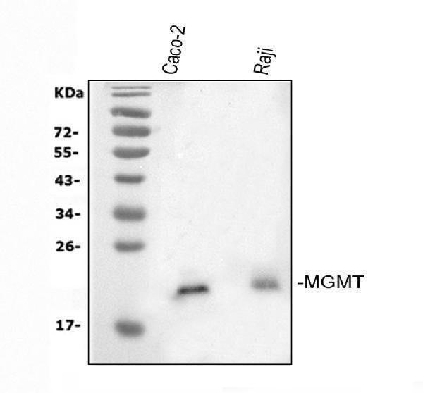 Anti-MGMT Antibody Picoband®