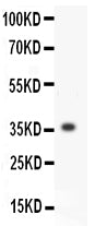 Anti-MMP3 Antibody Picoband®
