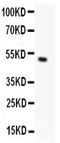 Anti-TRPC5 Antibody Picoband®