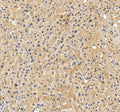 Anti-ABCB4 Antibody Picoband®