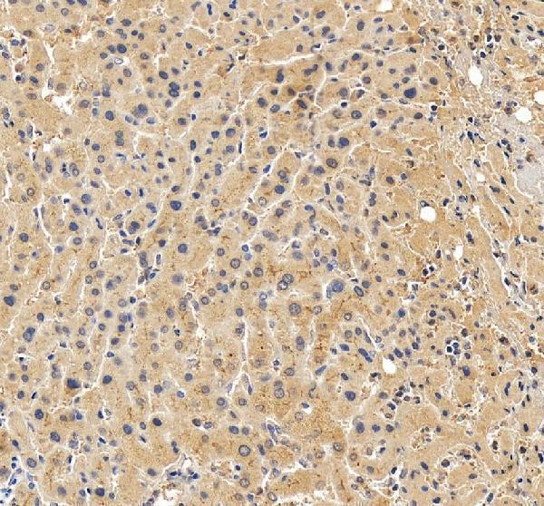 Anti-ABCB4 Antibody Picoband®