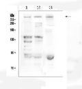 Anti-Dystrophin/DMD Antibody Picoband®