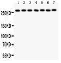 Anti-LRRK2 Picoband antibody, PB9281, Western blotting
All lanes: Anti LRRK2 (PB9281) at 0.5ug/ml
Lane 1: Rat Brain Tissue Lysate at 50ug
Lane 2: Mouse Brain Tissue Lysate at 50ug
Lane 3: Rat Liver Tissue Lysate at 50ug
Lane 4: U87 Whole Cell Lysate at 40ug
Lane 5: NEURO Whole Cell Lysate at 40ug
Lane 6: A549 Whole Cell Lysate at 40ug
Lane 7: SMMC Whole Cell Lysate at 40ug
Predicted bind size: 286KD
Observed bind size: 286 KD