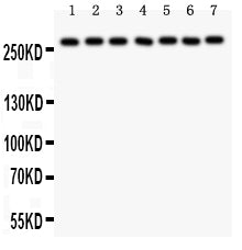 Anti-LRRK2 Picoband antibody, PB9281, Western blotting
All lanes: Anti LRRK2 (PB9281) at 0.5ug/ml
Lane 1: Rat Brain Tissue Lysate at 50ug
Lane 2: Mouse Brain Tissue Lysate at 50ug
Lane 3: Rat Liver Tissue Lysate at 50ug
Lane 4: U87 Whole Cell Lysate at 40ug
Lane 5: NEURO Whole Cell Lysate at 40ug
Lane 6: A549 Whole Cell Lysate at 40ug
Lane 7: SMMC Whole Cell Lysate at 40ug
Predicted bind size: 286KD
Observed bind size: 286 KD