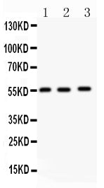 Anti-MMP14 Picoband antibody, PB9283, Western blotting
All lanes: Anti MMP14 (PB9283) at 0.5ug/ml
Lane 1: Human Placenta Tissue Lysate at 50ug
Lane 2: HELA Whole Cell Lysate at 40ug
Lane 3: U87 Whole Cell Lysate at 40ug
Predicted bind size: 55KD
Observed bind size: 55KD